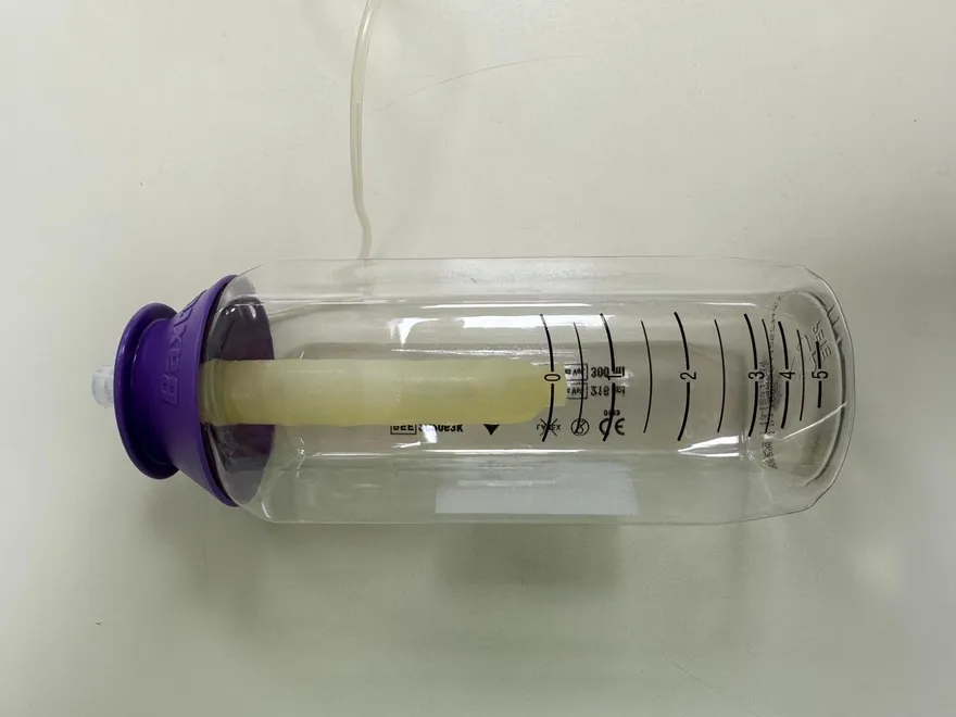 醫療科技突破！桃園醫院推「霹靂包」抗生素治療免住院