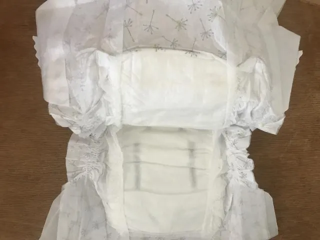 女子陰道滲尿！5次手術皆無效　醫解「骨灰級難題」獲國際肯定