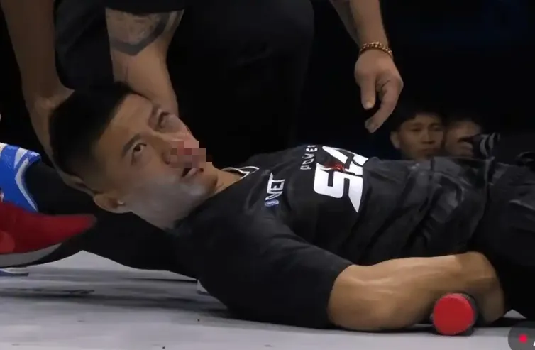 慘！陸通背拳傳人出戰打耳光大賽遭對手擊暈昏迷　本人回應