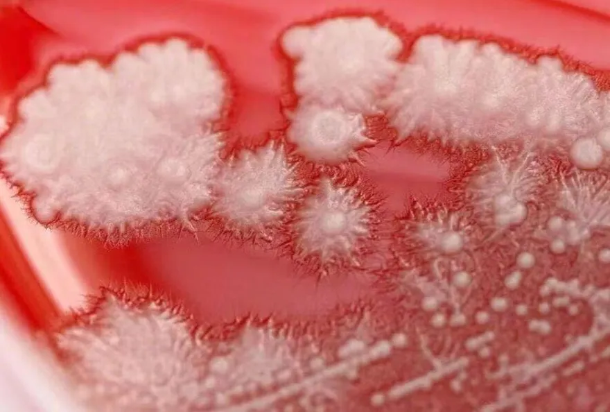 喉嚨痛自己買抗生素吃！陸男喉嚨竟「布滿雪花」嚇呆醫師