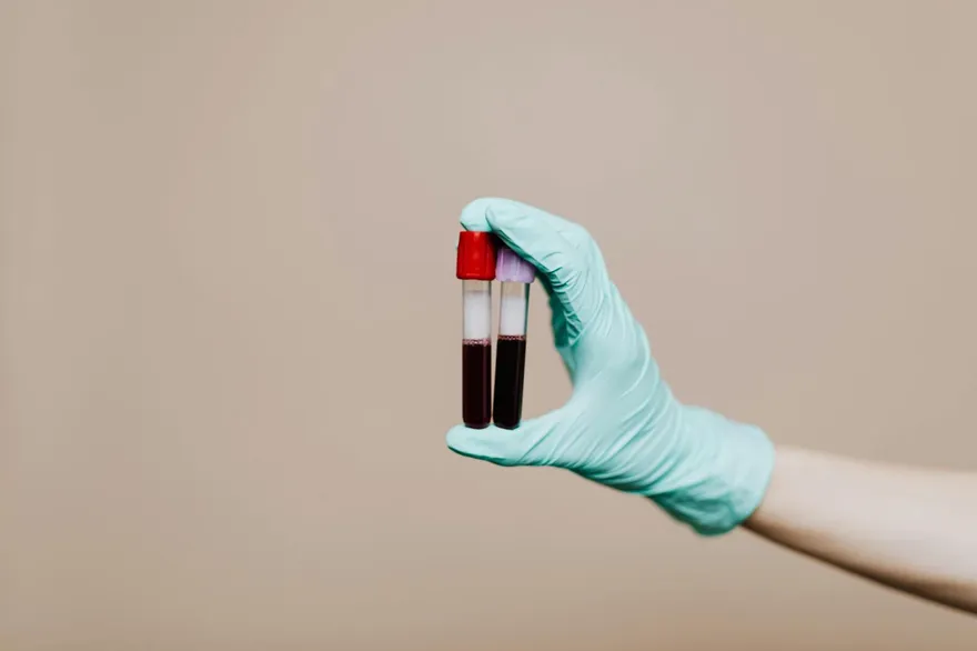 健檢報告正常還是會心梗？「動脈粥樣硬化指數」藏警訊