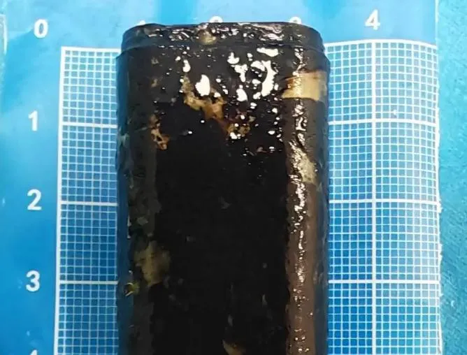 喝醉打賭吞打火機！陸男胃裡卡30年　取出「發黑泡爛」嚇壞醫