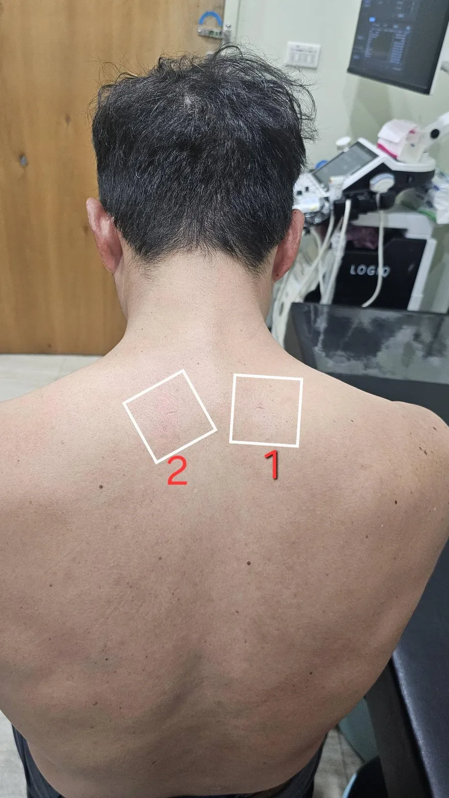 震驚！肩膀「氣結」非肌肉緊繃　醫：按摩沒用...是組織生病了