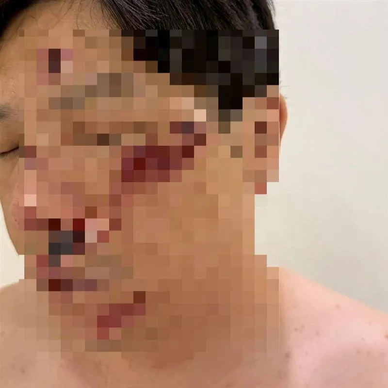 「女裝電商霸主」2度打運將百萬交保！發聲道歉自曝「整臉黑青照」