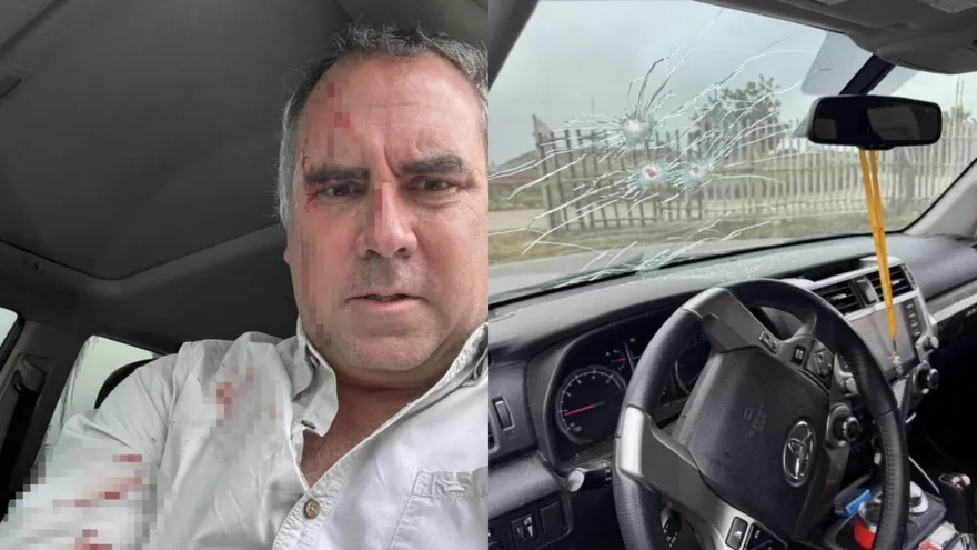 秘魯總統參選人遇槍襲「臉部爆血」　狂開12槍反擊脫險