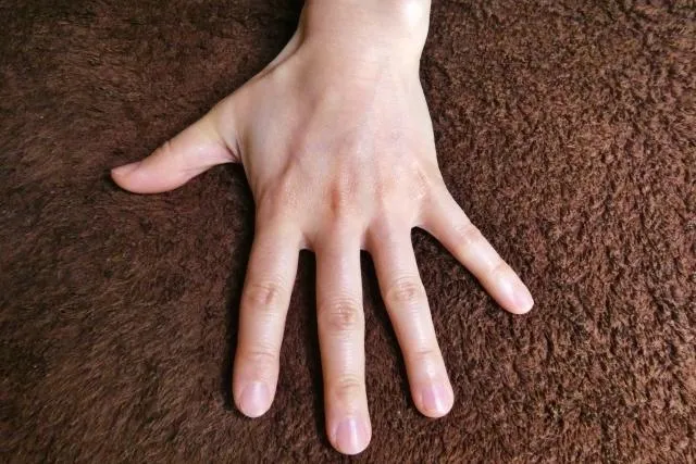 指甲出現「小白點」非缺鈣！醫揭真相：鋅不足才是主因