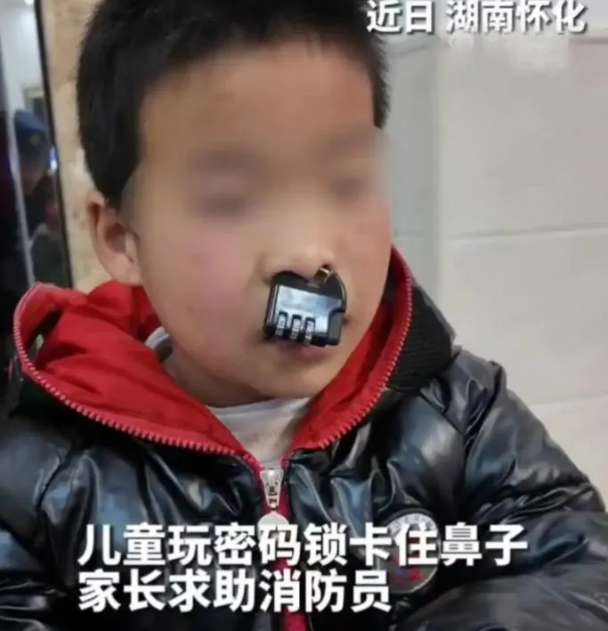影/陸男童玩密碼鎖「卡鼻」變牛魔王　消防員忍笑一鉗「解鎖」