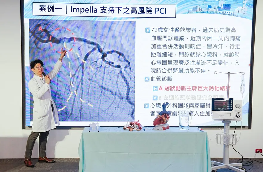 72歲女反覆胸痛！竟是心臟血管「嚴重鈣化」　機械循環輔助助攻