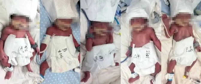 影/6000萬分之一的奇蹟！新疆24歲女順利產下「1男4女」五胞胎