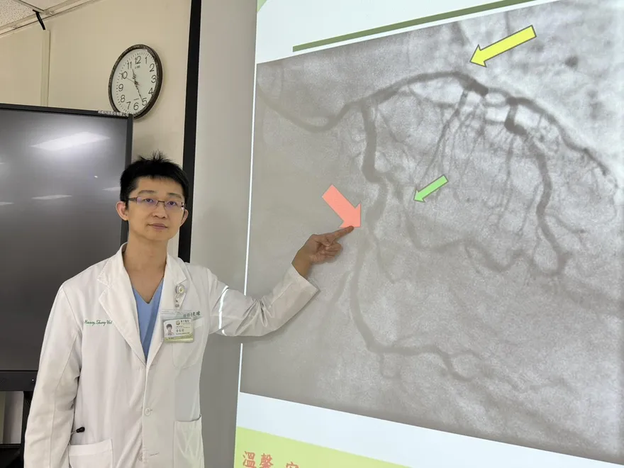 年輕體壯照樣心肌梗塞！他「三條心血管全堵」險送命