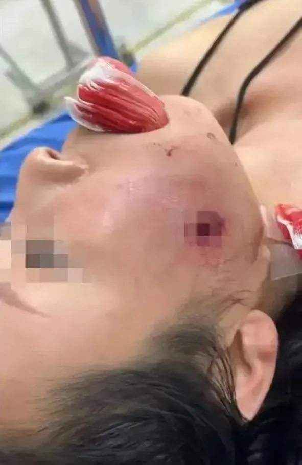 子彈穿臉卡舌！陸客遊普吉島玩射擊受傷　竟是員工玩槍走火