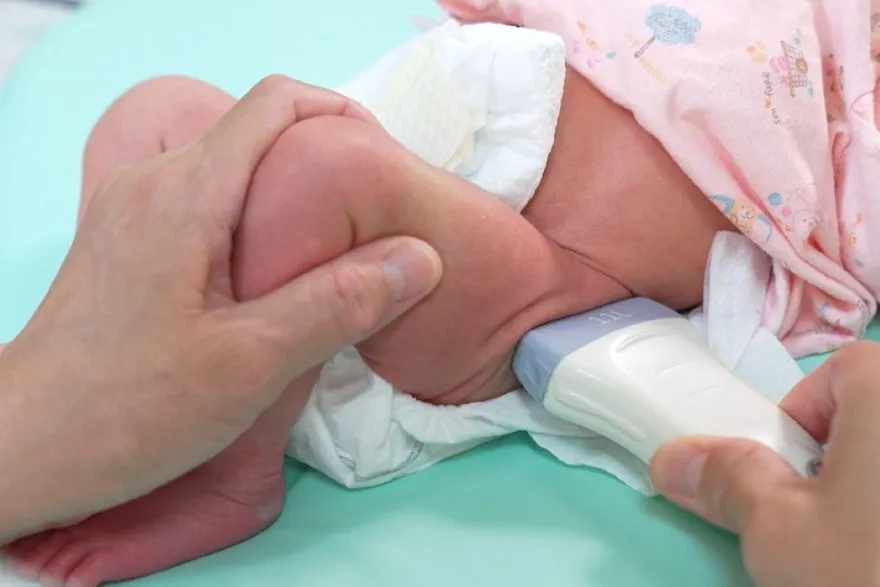 新生兒「髖關節脫臼」無聲無息！錯過6個月黃金期恐挨刀
