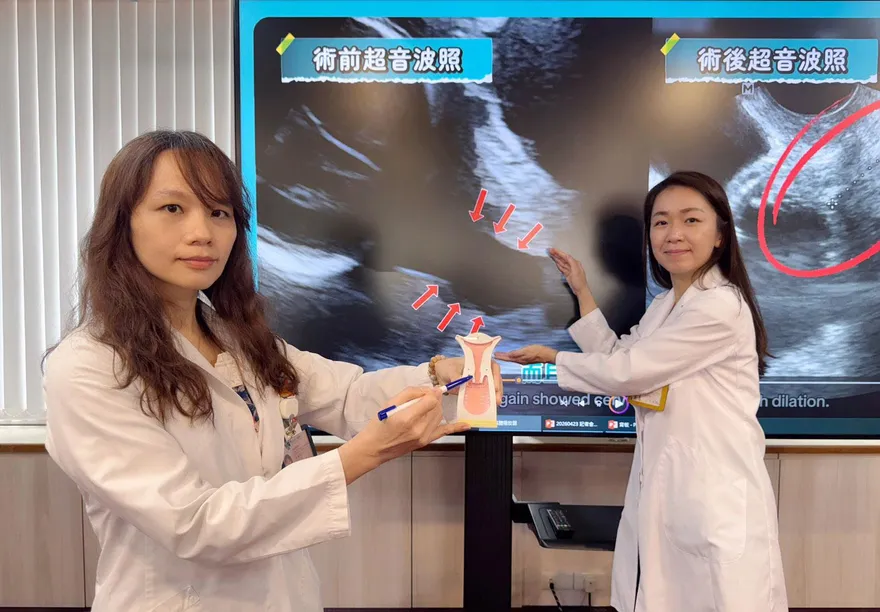 子宮頸縮短剩不到1公分！緊急「二度環紮」迎足月寶寶