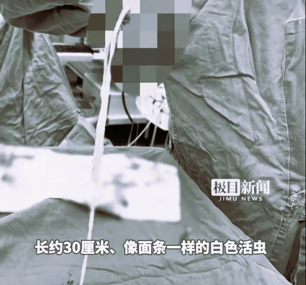 陸老婦乳房有硬塊…手術取出30cm活蟲　醫：游走炸彈恐致死