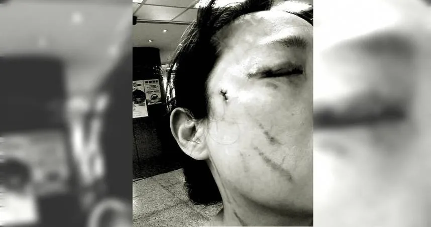 提醒戴口罩遭「挖眼砍傷」輕判8個月　苦主怒上訴：再死人才會被重視？