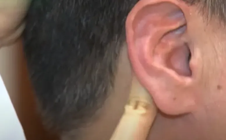 每天挖耳朵竟罹癌？！醫：跟嚼檳榔一樣「關鍵原因曝」