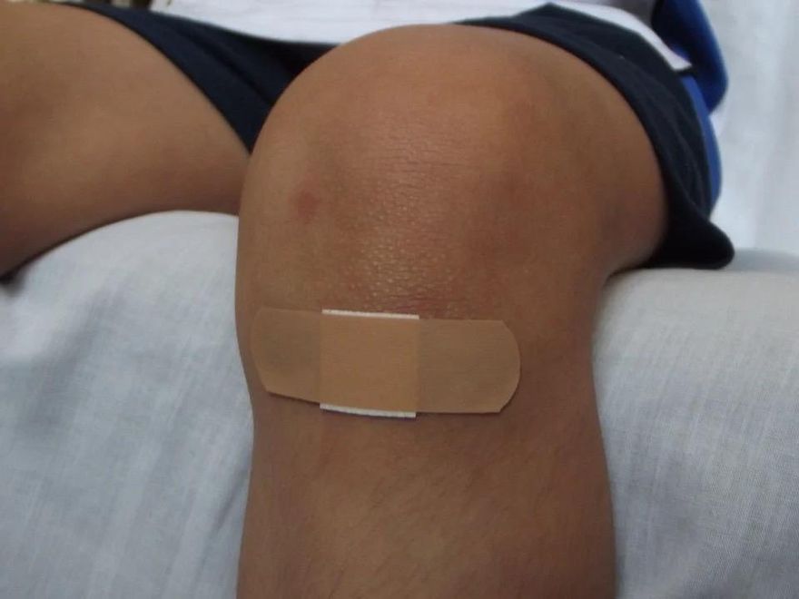 男童受傷感染「吃肉細菌」病逝！NHS警告：傷口出現10症狀馬上送醫