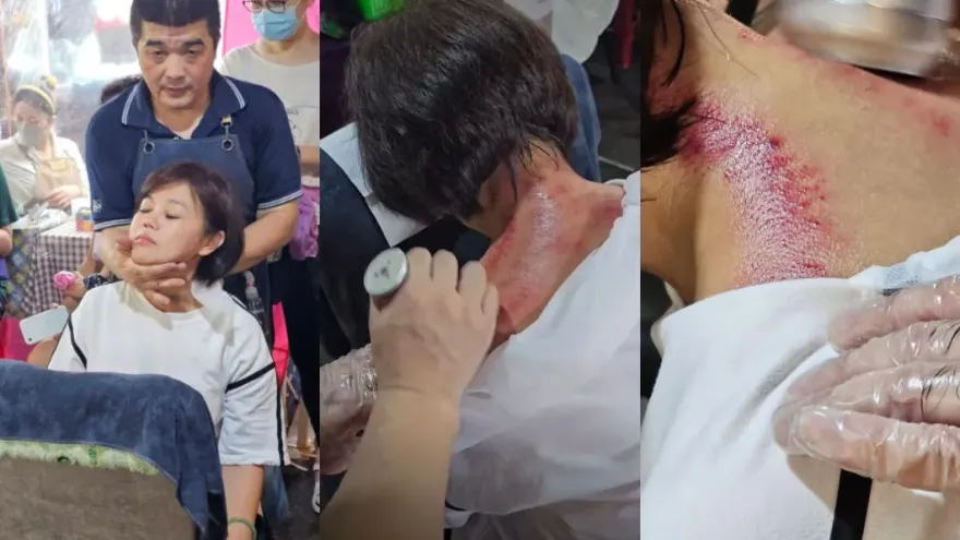 忍不下去了！游淑慧遭架脖子　自曝「血痕照」支持者心疼