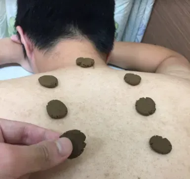 三伏天熱爆「過敏體質」可趁機改善！專家示警5類人不適合
