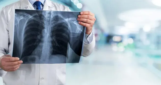 年奪5千命！肺阻塞「3症狀」易誤認感冒　若急性惡化後果不堪設想