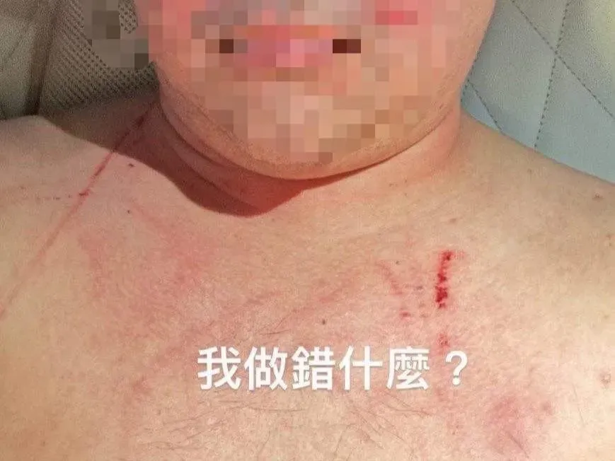 林千又控家暴疑反轉！賴姓富商抓痕傷勢曝光…悲喊：我做錯什麼
