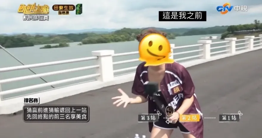 林襄自曝黑歷史！自嘲「髮際線超像清朝人」　坦承植髮重拾信心