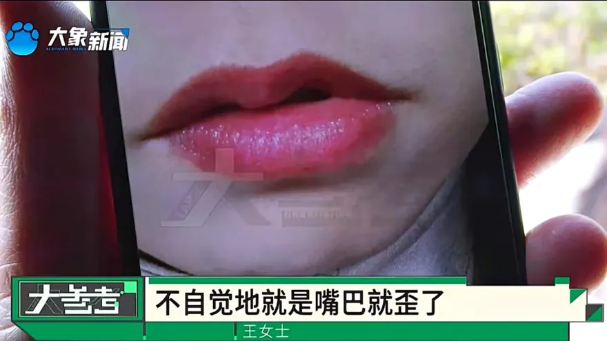 求「性福」！花2.7萬動私密手術　陸人妻怒：做完嘴巴歪了