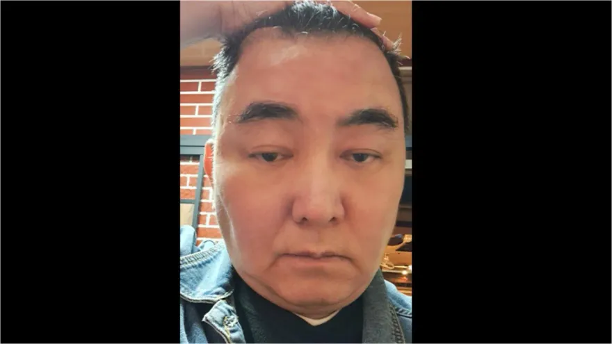 徐亨罹腦瘤！醫曝常見症狀：視腫瘤大小和位置而定