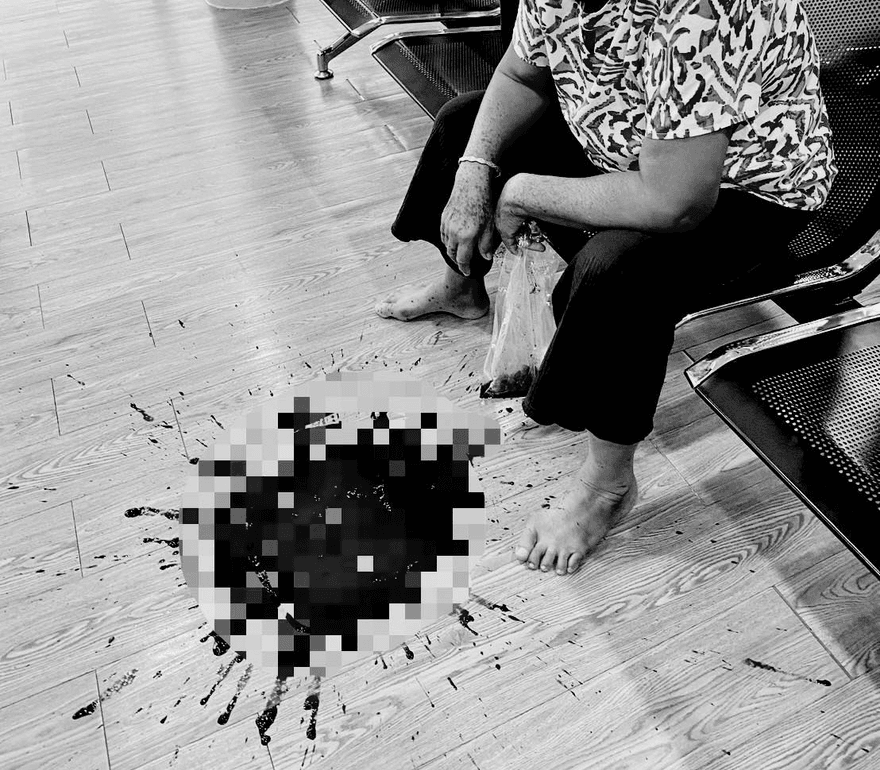 泰國婦胃炎狂吃止痛藥　3天後「吐血1公升」驚人畫面曝