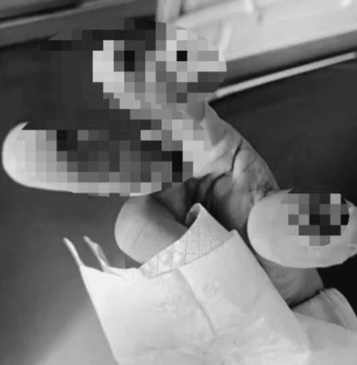悚！陸女散步誤踩「化骨水」容器　氫氟酸侵蝕慘死