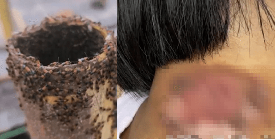 河南驚現大量「行走的硫酸」　女童沾到毒液脖子「紅腫潰爛」
