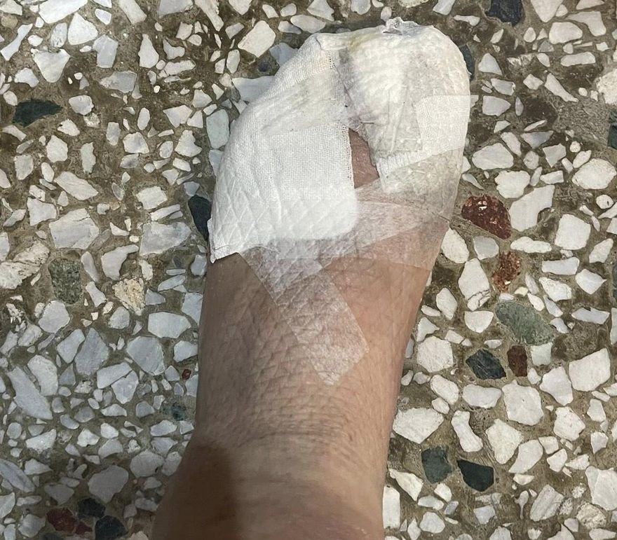 花蓮光復大安村長救災重傷　10腳趾「磨破皮快見骨」